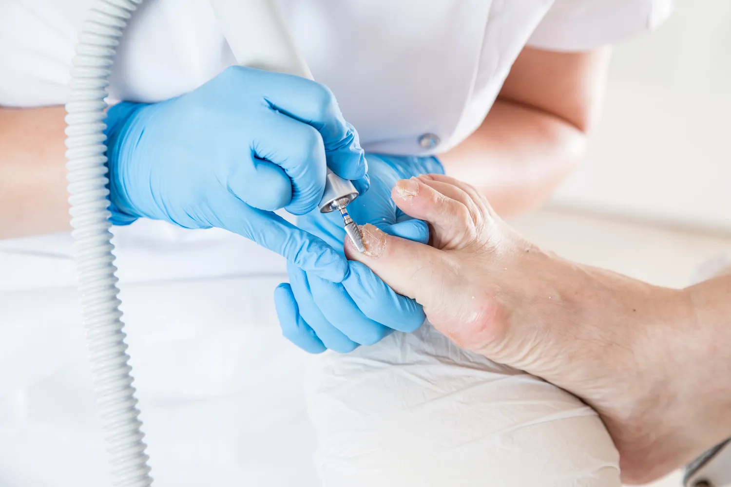 Pedicure leczniczy - czym jest i co warto wiedzieć na jego temat?