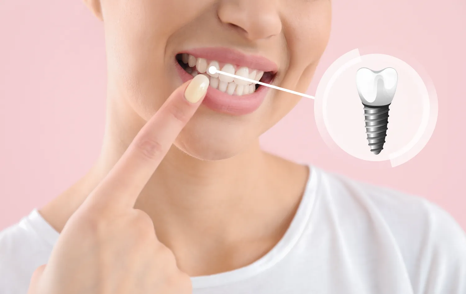Endodoncja mikroskopowa Szczecin